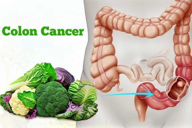 How to reduce cancer risk ?